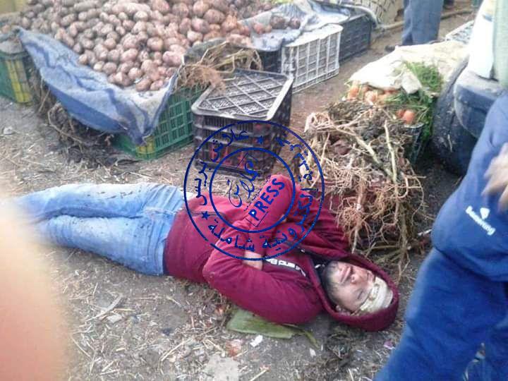 صورة بالصور : عصابة إجرامية تعتدي على تاجر بالسوق الخميس الإسبوعي بسيدي بطاش