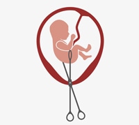 صورة توقيف طبيب بالقطاع الخاص ومساعدته في حالة تلبس بمحاولة إجراء عملية لإجهاض حمل فتاة قاصرة تبلغ من العمر 15 سنة