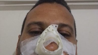 صورة اعتداء شنيع على استاذ بالسمارة: