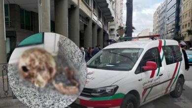 صورة في وقت وجيز.. أمن طنجة يتمكن من حل لغز “الجمجمة المجهولة”